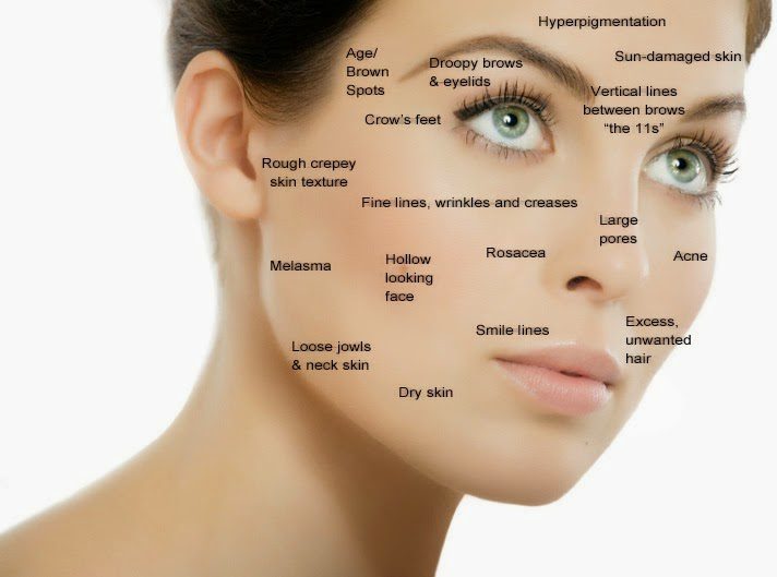 Is Accutane Treatments safe with Spray Tanning?